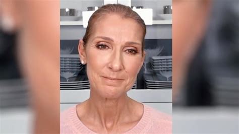 Choroba Céline Dion wciąż postępuje Na czym polega Dzień Dobry TVN