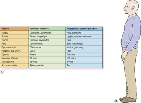 Parkinsons Disease Neupsy Key