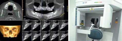 Tomografia Computadorizada Cone Beam Barra Laudo