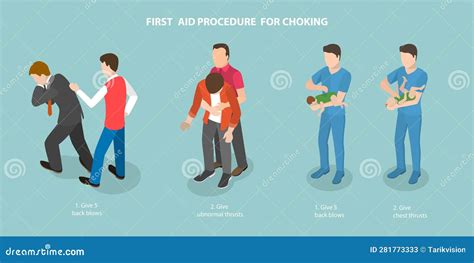 3D Isometric Flat Vector Conceptual Illustration of First Aid Procedure for Choking Stock Vector ...