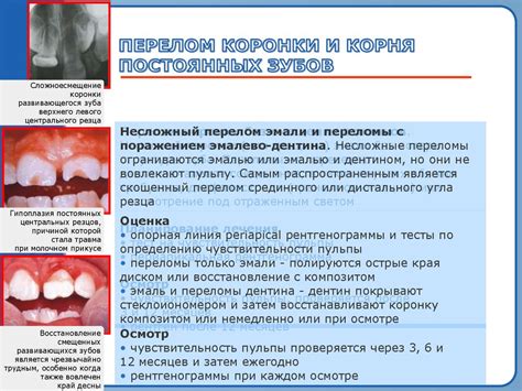 Травма зуба - презентация онлайн