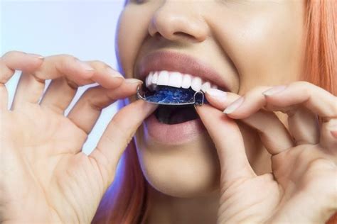 Adult Teeth Straightening Options Guide Smile Makeover