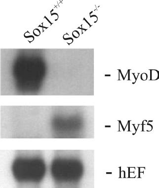 Expression Of Myogenic Determination Factors Myod And Myf In Primary