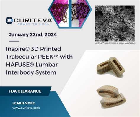 Inspire® 3d Printed Trabecular Peek™ With Hafuse® Lumbar Interbody