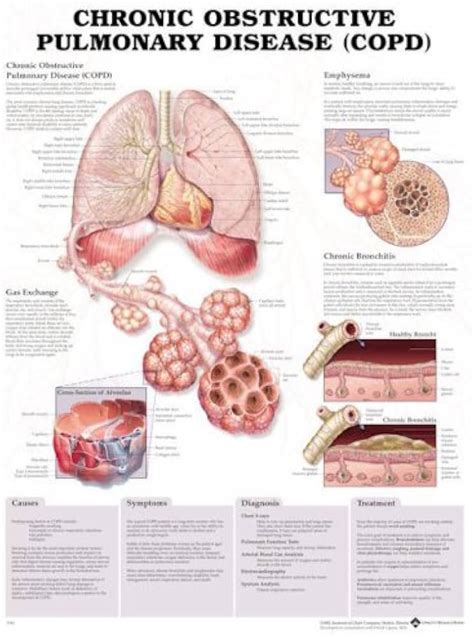 Copd Causes Symptoms Diagnosis Treatment Prevention Off