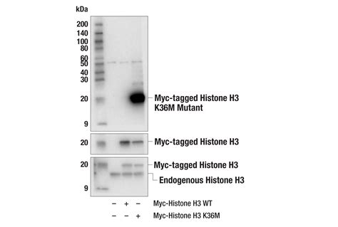 Histone H3 K36M Mutant Specific E8N1L Rabbit MAb Cell Signaling