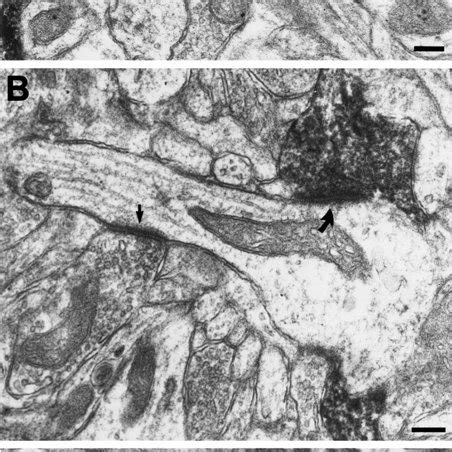 Electron Micrographs Of Biotinylated Dextran Amine BDA Labeled