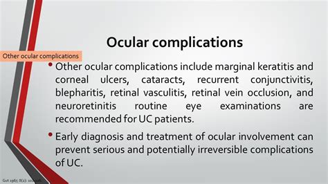 Ulcerative Colitis: Ocular complications