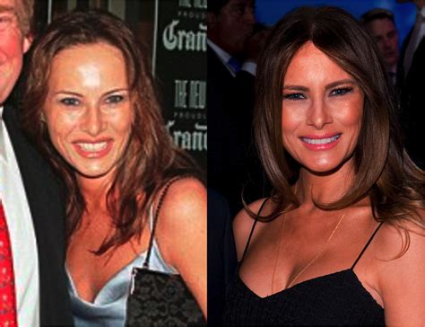 Trumps Women And Plastic Surgery Sheryl Canter Medium