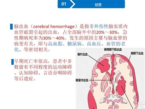 监测有道丨脑血管意外患者的icp（颅内压）探头植入手术与监测——颅脑创伤 神经重症周刊（第227期） 脑医汇 神外资讯 神介资讯