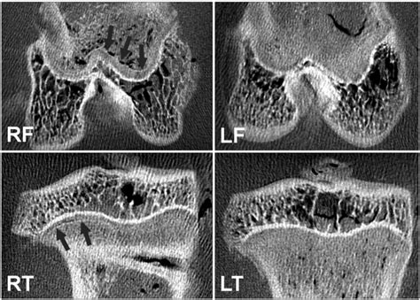 Contrast Enhanced Micro Computed Tomography Images Showed That A Thin