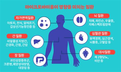 살↓ 근육↑ 마이크로바이옴 2종 어떤 음식에 코메디닷컴