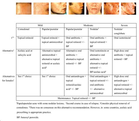 Acne Vulgaris Treatment