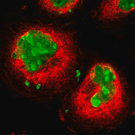 Anti Mki Antibody Produced In Rabbit