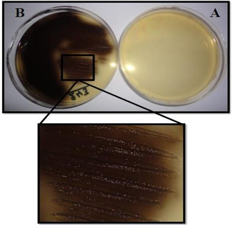 Bile Esculin Agar Medium (A) Medium without culture. (B) Esculin ...