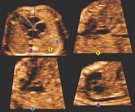 Simple Targeted Arterial Rendering Star Technique A Novel And Simple