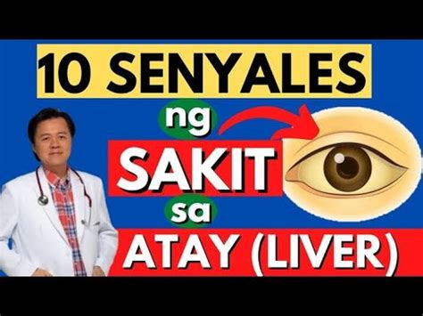 10 Senyales Ng Sakit Sa Atay Liver By Doc Willie Ong Internist