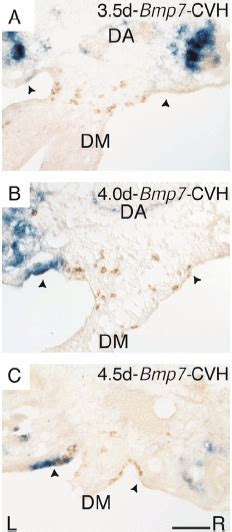 Asymmetric Expression Of Bmp7 At The Beginning Of Genital Ridge