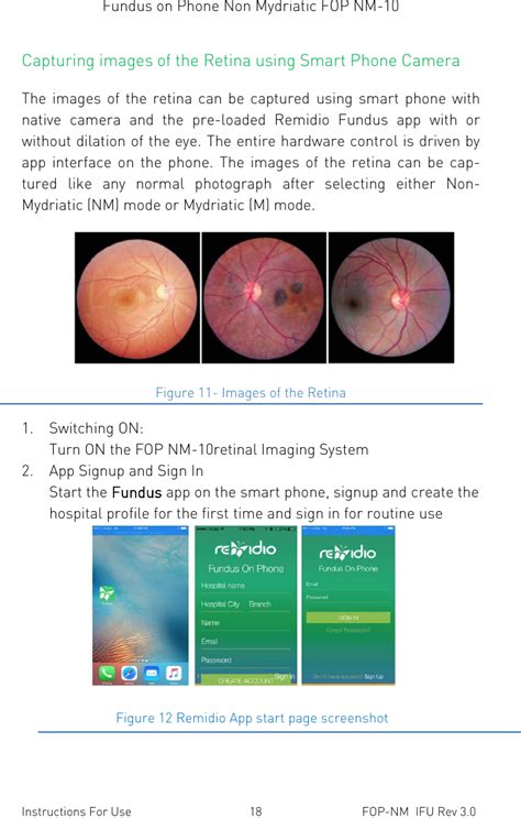 Remidio Innovative Solutions Private Fopnm 10 Fundus On Phone Non