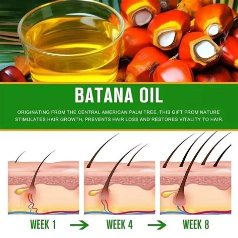 Organic Batana Oil Hair Growth Oil Botana Oil Sourced From Honduras 100ml Ebay