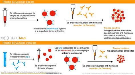 Test Di Coombs Diretto E Indiretto Positivo E Negativo Hot Sex Picture