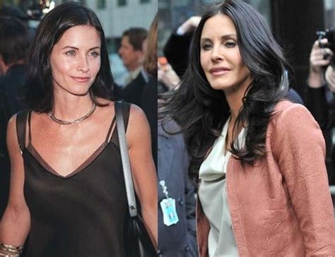 Courteney Cox before and after plastic surgery () | Celebrity plastic surgery online