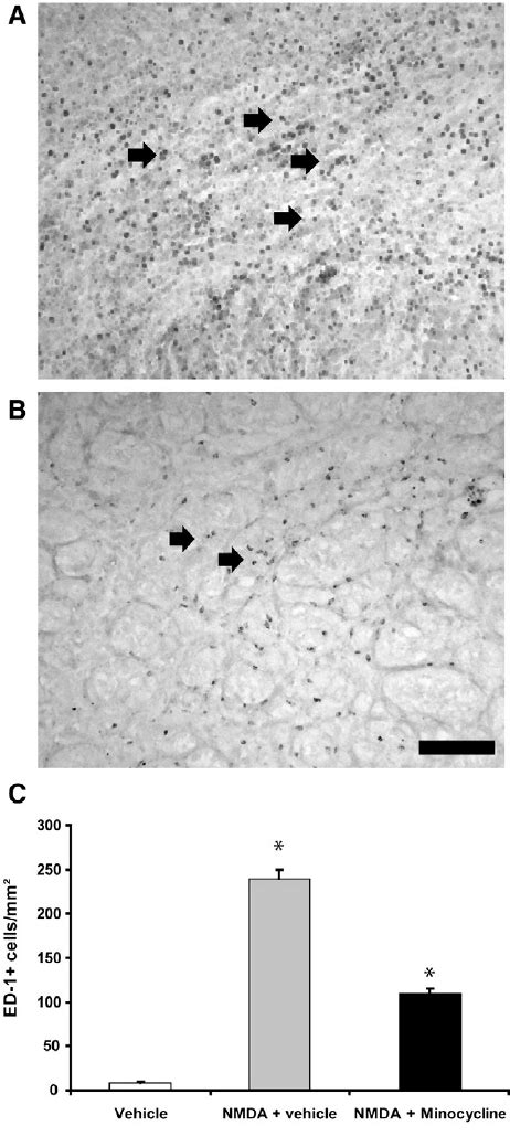 Blockage Of Microglial Activation By Minocycline Microglial