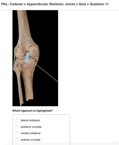 Solved PAL Cadaver Appendicular Skeleton Joints Quiz Chegg