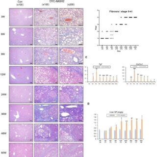 Development Of Fibrosis And Expression Of Fibrosis Related Genes During