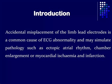 Ecg Limb Lead Reversal Ppt