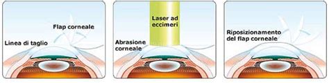 V Gott Kellemetlen K Zik Nyv Laser Occhi Asl Nagy Univerzum Hi Baval Kakas