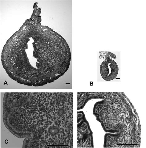 In Situ Hybridization Analysis Of Runx3 Mrna In Mouse Uteri Uterine