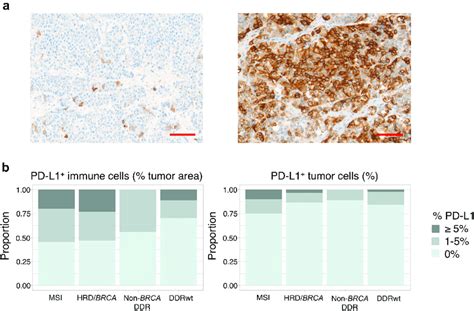 Pd L1 Expression A Examples Of Pd L1 Stainings The Left Image Shows