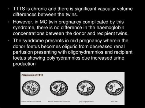 Twin to twin transfusion syndrome