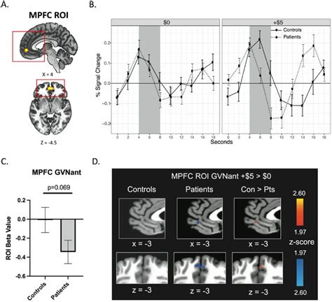 Medial Prefrontal Cortex Activity During Reward Anticipation A