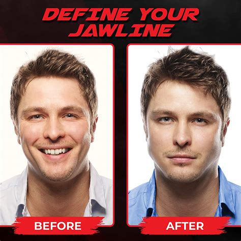 Defined Jawline Before And After