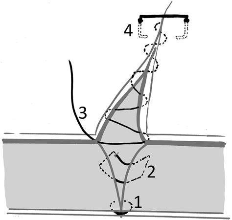 Schematic Representation Of The Four Layer Closure Method 1 Fascia