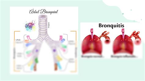 Solution Bronquitis Aguda Y Cr Nica Studypool