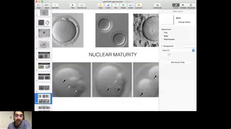 OOCYTE QUALITY ASSESSMENT YouTube