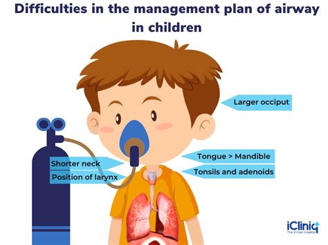 What Is Airway Management For Pediatric Anesthesia