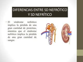 Sindrome Nefritico Ppt