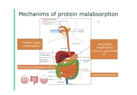 LSRC Biomed 1 2 Digestion And Absorption Of Food Flashcards Quizlet