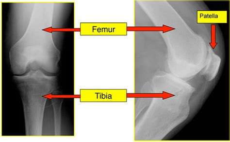 Dr Craig J Della Valle Hip And Knee Surgeon Basic Knee Anatomy Dr