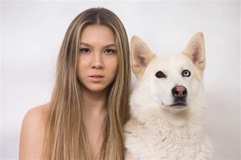 Menschen Mit Iris Heterochromie Haben Zwei Verschiedene Augenfarben Und