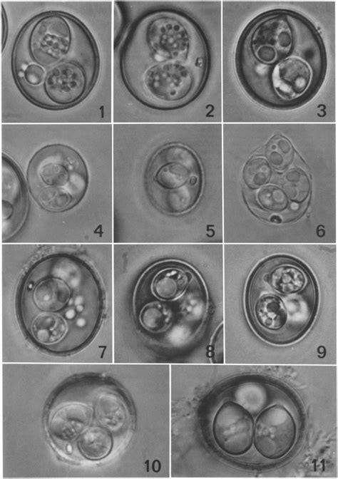 Photomicrographs Of Sporulated Oocysts Of Coccidia Collected From The