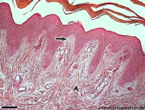 Atlas De Citologia E Histologia Tecido Conjuntivo