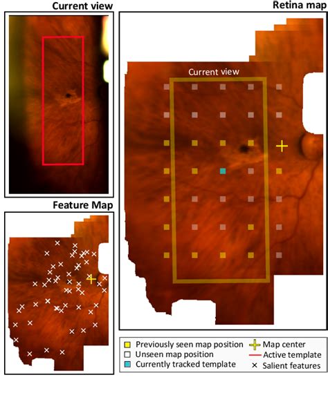 Figure 1 From Fundus Image Mosaicking For Information Augmentation In