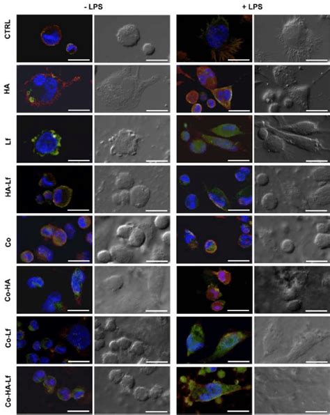 The Polarization Of Differentiated THP 1 Cells On Biomimetic Coatings