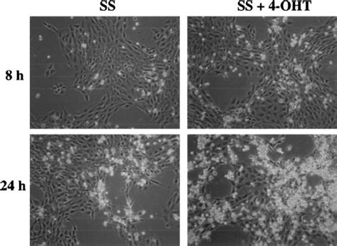 Apoptosis Induced By Activation Of C Myc In Serum Starved Rat1