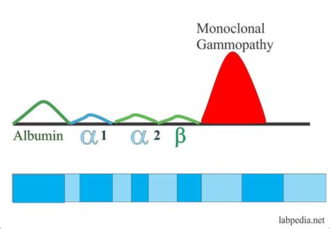 Protein Serum Electrophoresis Total Protein Albumin And Globulin